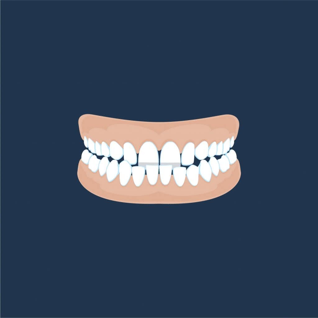 Corinna St Orthodontics Underbite